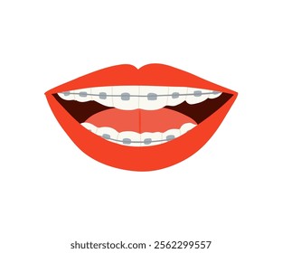 A smile with braces is drawn in a flat style. Healthy smile, braces, lips. Hand drawn vector illustration.