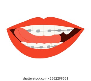 A smile with braces is drawn in a flat style. Healthy smile, braces, lips. Hand drawn vector illustration.