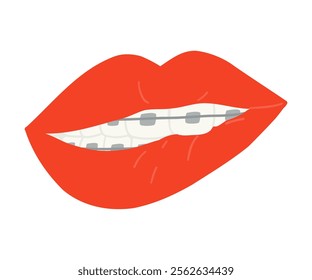 A smile with braces is drawn in a flat style. Healthy smile, braces, lips. Hand drawn vector illustration.