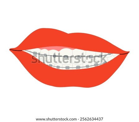 A smile with braces is drawn in a flat style. Healthy smile, braces, lips. Hand drawn vector illustration.