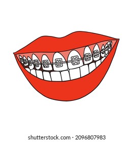 2 Braces Vs Invisible Images, Stock Photos & Vectors | Shutterstock