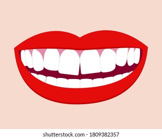 Smile Mouth With Crooked Teeth. Vector Isolated Elements EPS10