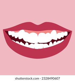 Smile with orthodontic problem teeth crowding. Double tooth. Abnormal eruption. Opposite occlusion, open bite, crowded teeth, cavities, dentition. Vector illustration