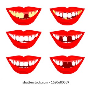 Smile with teeth on a white background. Dentistry Problems and dental prosthetics. Vector illustration.