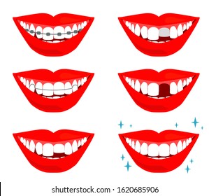 Smile with teeth on a white background. Dentistry Vector illustration.