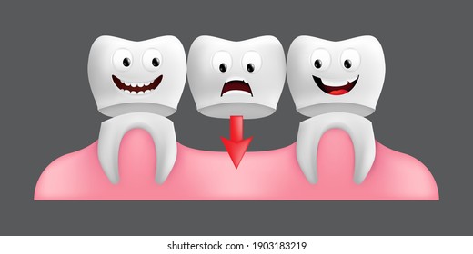 Smiling teeth with fixed bridgework. Cute character with facial expression. Funny icon for children's design. 3d realistic vector illustration of a dental ceramic model isolated on a grey background