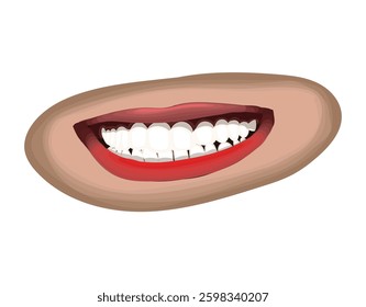 Smiling, Teeth, Tooth and Lips, laugh and smile. Dental use