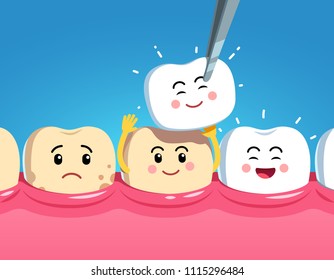 Smiling and upset animated cartoon teeth characters on gum and veneer. Funny teeth dental restoration characters. Putting new veneer on discolored tooth. Flat style vector illustration on blue backgro