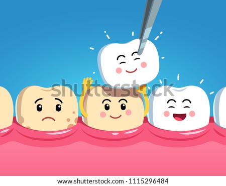 Smiling and upset animated cartoon teeth characters on gum and veneer. Funny teeth dental restoration characters. Putting new veneer on discolored tooth. Flat style vector illustration on blue backgro