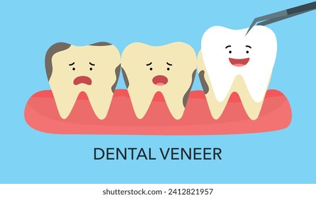 Smiling and upset teeth cartoon character on gum and veneer. Funny teeth dental restoration. Putting new veneer on discolored tooth.