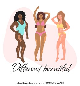 Smiling women in swimsuits of different nationalities and physiques with vitiligo. Different beautiful lettering. World vitiligo day.