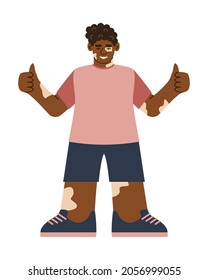 Smiling Young African Man, Teenager With Vitiligo. A Happy, Confident Black Schoolboy With White Pigmentation. Vector Illustration In Flat Style.