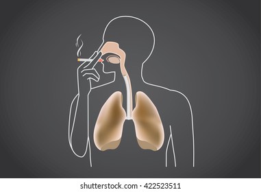 Smoker's lung is black from tar.