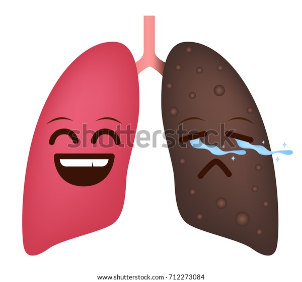 Smokers Lung Healthy Lung Cartoon Vector เวกเตอร์สต็อก (ปลอดค่า