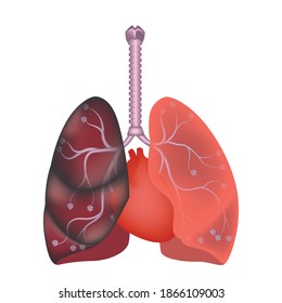 86 Smoker's Lungs Stock Vectors, Images & Vector Art | Shutterstock
