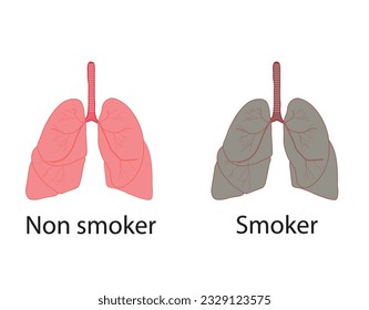 Smoker's lungs and healthy lungs. smoker and non smoker lungs. Vector illustration.