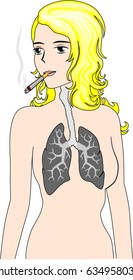 Smoker's woman lungs