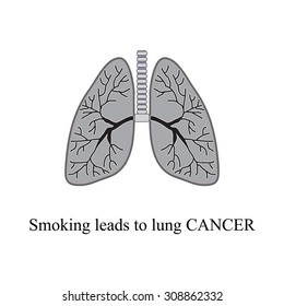 Smoking leads to lung cancer. Vector illustration on isolated background.