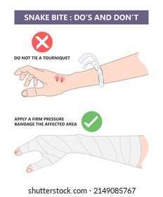 44 Snakebite first aid Images, Stock Photos & Vectors | Shutterstock