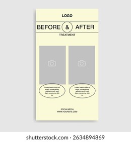 Social Media Template Simple Minimalist for Skin care and beauty treatment , spa salon promotional