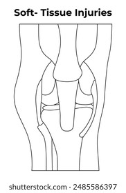 Diagrama de Ilustración vectorial de diseño de Ciencia de lesiones de tejidos blandos