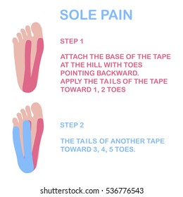 Sole pain. Correct kinesiology taping. Vector illustration.