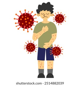 someone infected with the MPOX virus. monkey pox disease. MPOX virus emergency. orthopoxvirus type virus. vector illustration. flat style. health theme. virus outbreak.