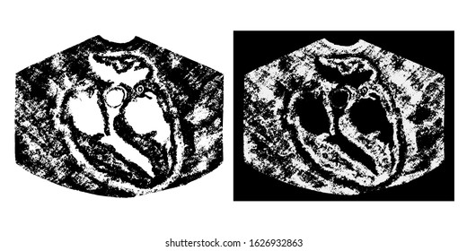 Sonogram of the human heart in realistic style. Heart ultrasound vector illustration isolated on white and black background. Echo-cardiogram internal organs. Anatomy cardio ultrasound vector image