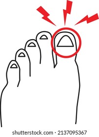 Sore Big Toe Icon On White Background. Foot Pain Sign. Leg With A Toe Injury Symbol. Flat Style.