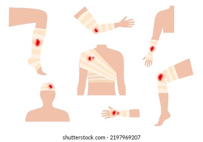 Sore, cut or ulcer on the human body. Pain in leg, arm, shoulder or head. Bandage, medical gauze wrapping. Broken or injured bones, first help. Male silhouette. Limbs trauma vector flat illustration.