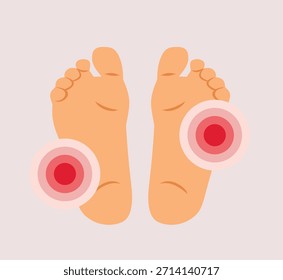 
Dolor en las plantas de los pies por la Ilustración vectorial para caminar. Persona con síntomas de reumatismo y artritis 
