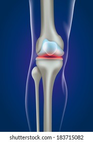 sore knee
