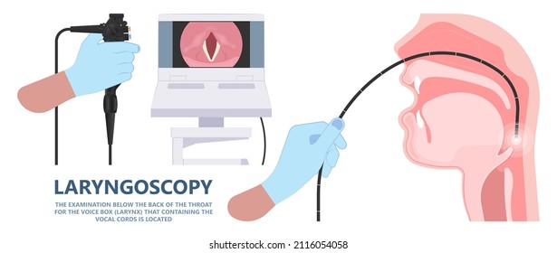 Sore Loss Cough Virus Viral Acute Swell Sound Folds Treat Cysts Palsy Nerve Tumor Botox Throat Hoarse Larynx Airway Polyps Cancer Injury Speech Damage Ulcers Box Chronic Nodules Surgery Reflux Upper