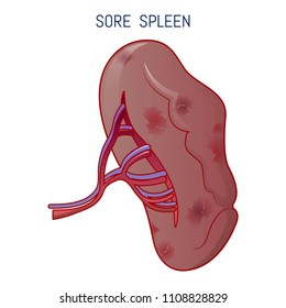 Sore spleen icon. Cartoon of sore spleen vector icon for web design isolated on white background