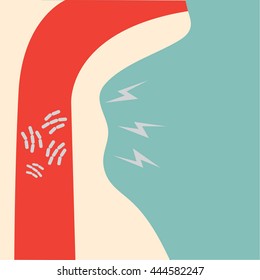  Sore Throat and Other Throat Problem,(sore throat flu disease) ,Vector illustration