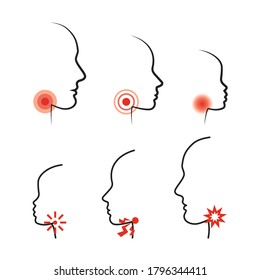 Ilustraciones de iconos de vectores de garganta. Perfil Silhouettes del síntoma de gripe y tos con Ache local en glándulas. Cabeza masculina, femenina e infantil con dolor de garganta. Diseño de logotipo de medicamentos para pulverización o pastillas