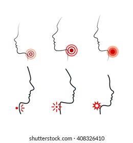 Sore Throat Vector Illustrations. Men, Women and Kid Feel Pain in Throat. Profile Silhouettes with Ache Locations. Icon Design for Medical Packaging of Tablets, Pills, Spray or Lozenges Local Impact.