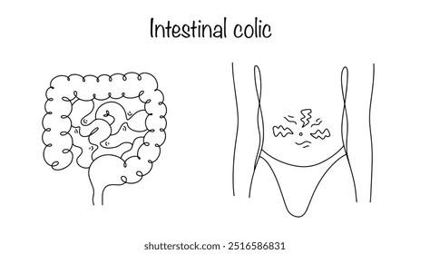 Spasm of the walls of the smooth muscles of the intestine. The patient experiences severe pain in the navel area associated with contraction of the intestinal walls. Medical vector.