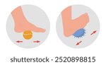 Special exercise for food deformation problem. Orthopedist Therapeutic and strengthening foot with tennis ball and fitness massage ball 