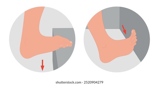 Special exercise for food deformation problem. Orthopedist Therapeutic and strengthening using wall or furniture