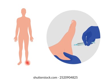 Special exercise for food deformation problem. Orthopedist Therapeutic and cure with injections 