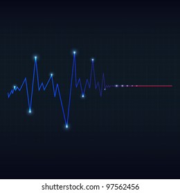 special heart cardiogram
