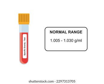 Specific Gravity Blood Test Concept Design. Vector Illustration.	