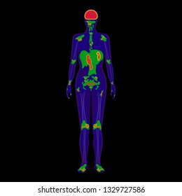 SPECT scan radiologist single computed image CT PET 3D radiotracer Radioiodine I-131 examines uptake treat iodine radiology radioactive diagnosis diagnose radioisotopes radiopharmaceuticals