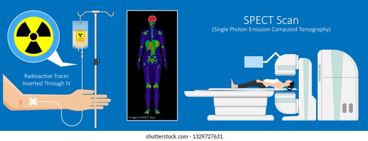 SPECT scan radiologist single computed image CT PET 3D radiotracer Radioiodine I-131 examines uptake treat iodine radiology radioactive diagnosis diagnose radioisotopes radiopharmaceuticals