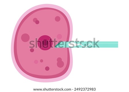 sperm and egg fertillization. In Vitro Fertillization , IVF