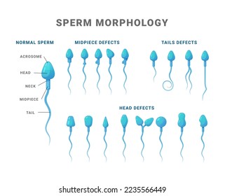 Sperm morphology count type educational medical scheme vector flat illustration. Biology fertility diagram science medicine diagram structure normal midpiece tail head defect example explanation