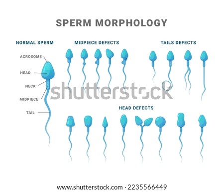 Sperm morphology count type educational medical scheme vector flat illustration. Biology fertility diagram science medicine diagram structure normal midpiece tail head defect example explanation Stock photo © 