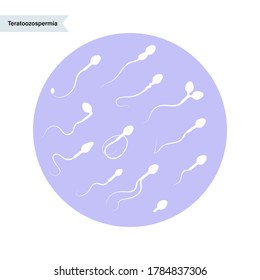 Morfología de esperma e investigación de ivf. Huevo humano normal, anormal y defectuoso. Ilustración vectorial plana de espermatozoo. Concepto del sistema sexual de reproducción humana. Afiche para clínicas y educación