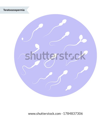 Sperm morphology and ivf research. Normal, abnormal and defective human egg. Spermatozoon flat vector illustration. Human sexual reproductive system concept. Poster for clinic and education